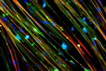 The restoration of dystrophin (stained green) in Duchenne muscle cells is shown above.