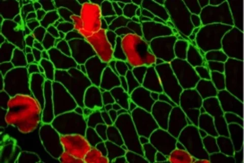 Muscle membrane illuminated in green and red.