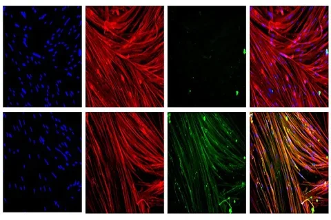 Skeletal muscles without dystrophin (top row) and after dystrophin has been restored (bottom) using the CRISPR/Cas9 platform developed by UCLA scientists.