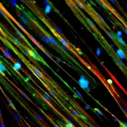 The restoration of dystrophin (stained green) in Duchenne muscle cells is shown above.